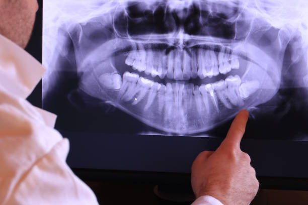 Best Cracked Tooth Emergency Dentist  in Atkinson, IL