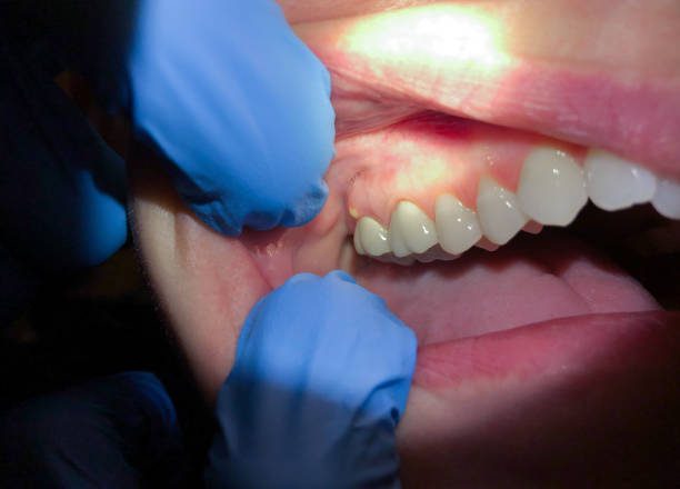Best Root Canal Emergency Dentist  in Atkinson, IL