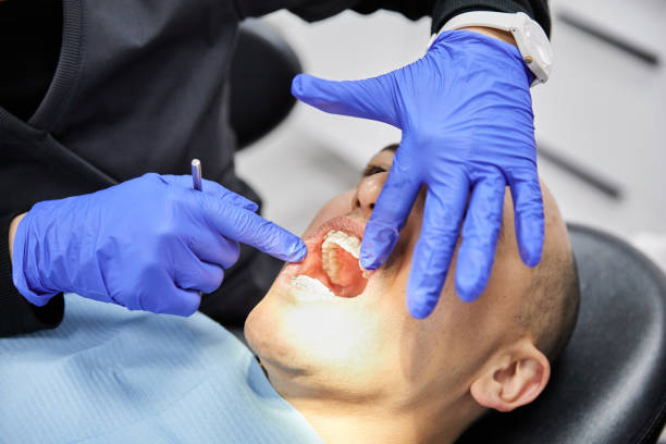 Best Knocked-Out Tooth Emergency  in Atkinson, IL
